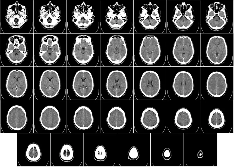Your Brain Is Already Betting Against You Before You Place a Single Wager